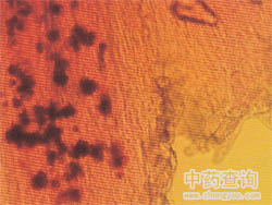 西红花显微特征(局部放大图，示结晶)
